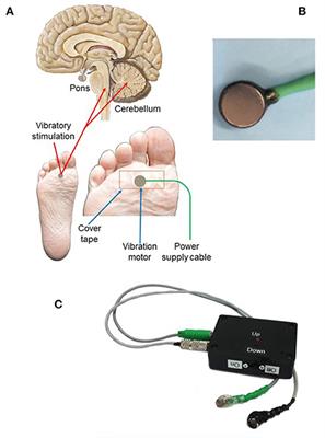 Pilot Safety and Feasibility Study of Non-invasive Limb Proprioceptive Cerebellar Stimulation for Epilepsy